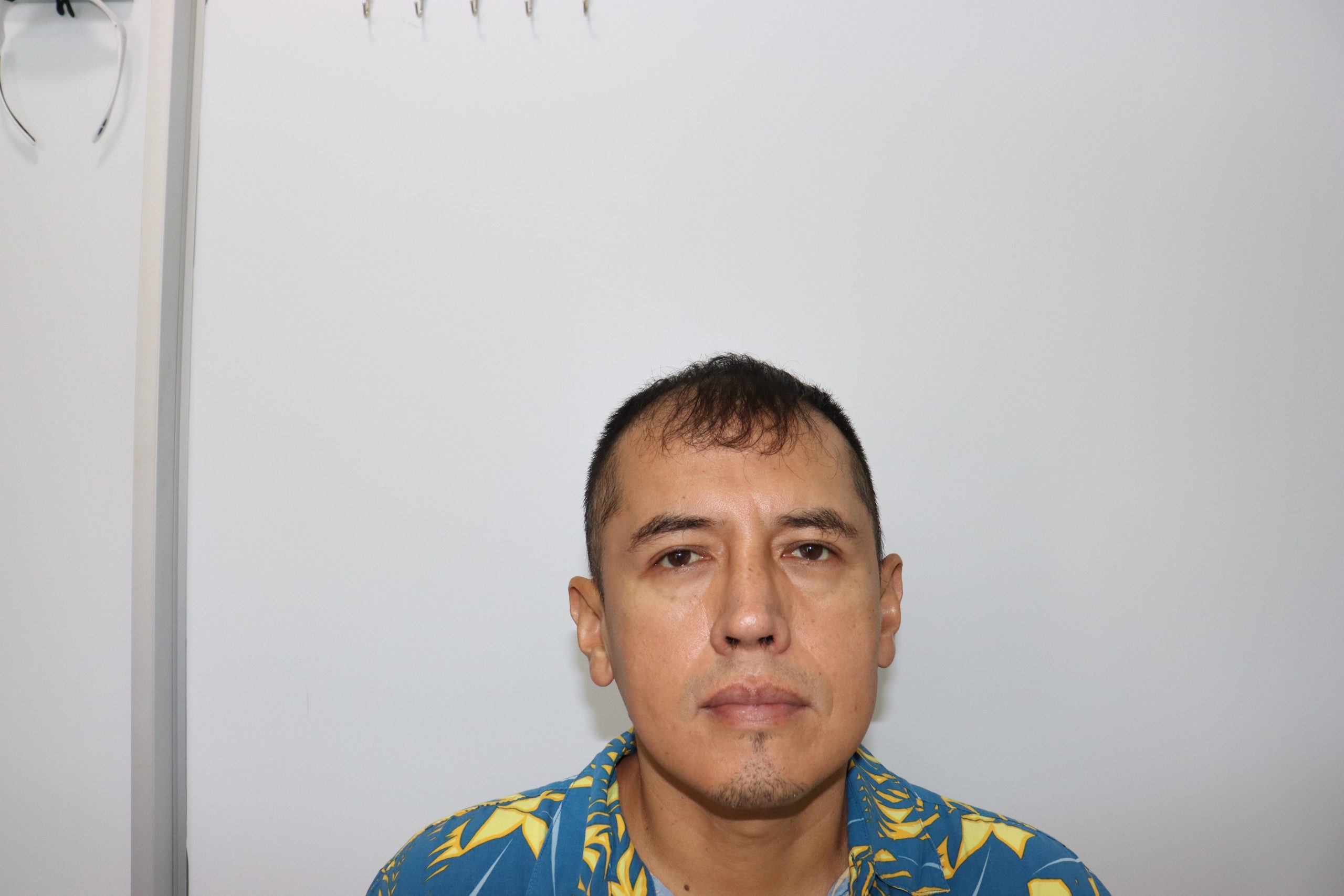 Antes del tratamiento - Caso 2